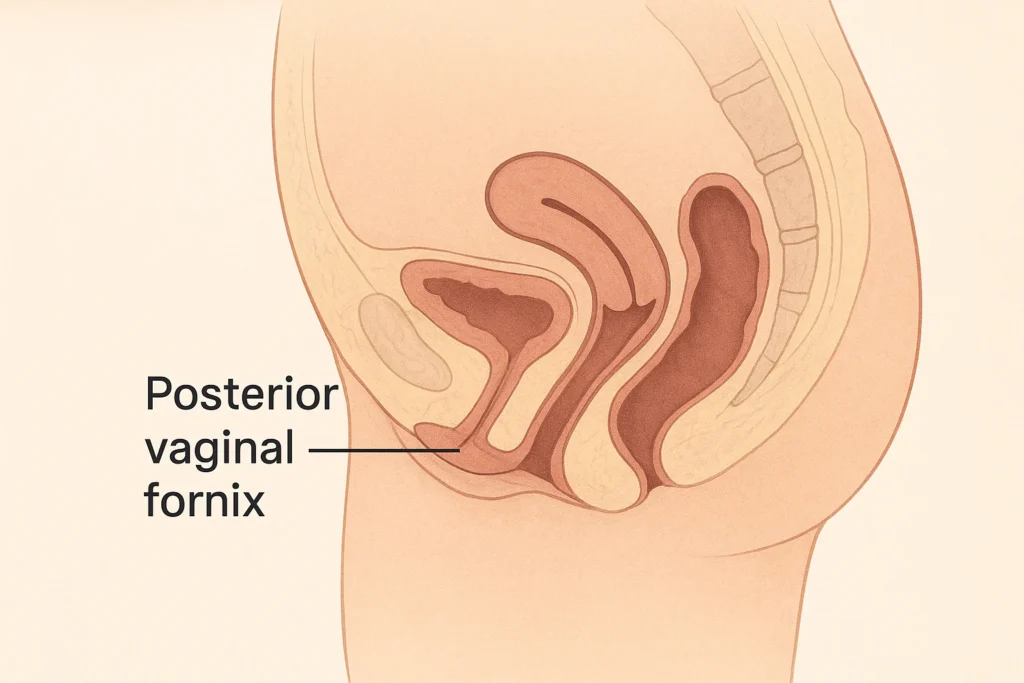 posterior vaginal fornix